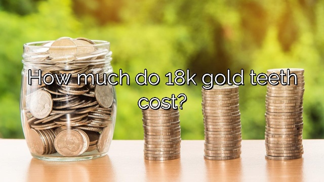 How much do 18k gold teeth cost?