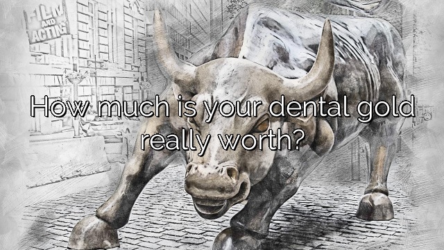 How much is your dental gold really worth?